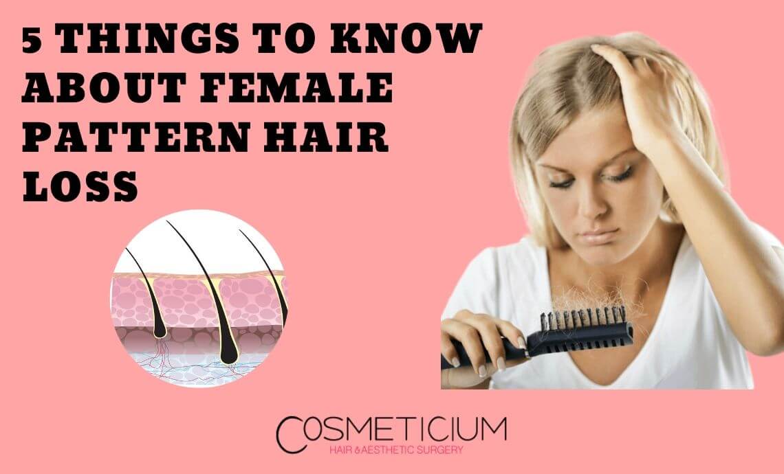 5 Things to Know About Female Pattern Hair Loss