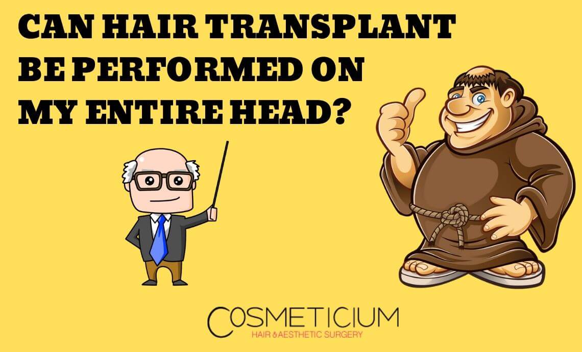 Can Hair Transplantation Be Performed On My Entire Head?