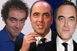 James Nesbitt’s Hair Transplantation