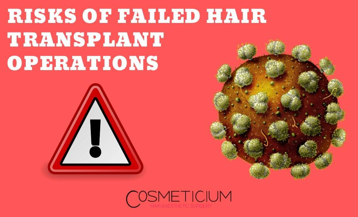 Risks of Failed Hair Transplant Operations (Illustrated)
