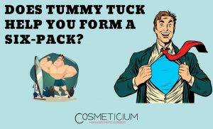 Tummy Tuck and Six-Pack
