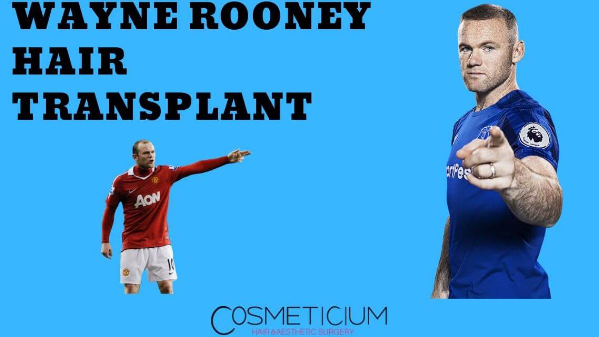Crown Clinic on Twitter Has Wayne Rooney had a third hair transplant Our  consultant hair transplant surgeon DrAsimShahmalak sifts through the  evidence in his new blog httpstco4zDDsNVcwP httpstcosP7GG9lAvy   Twitter