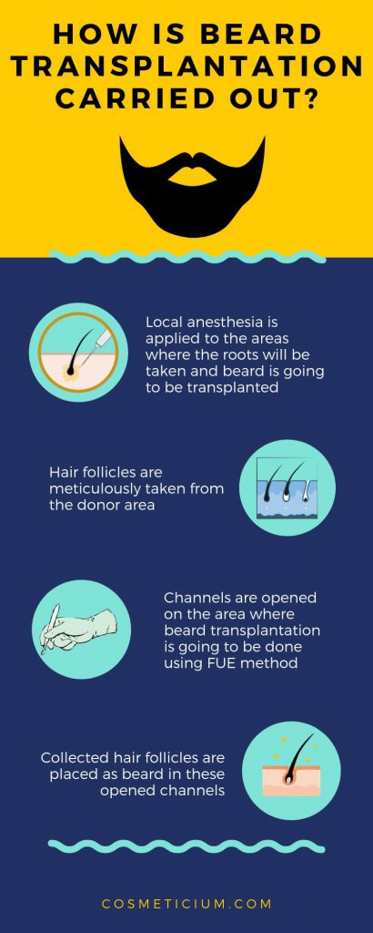 beard transplant process infographic