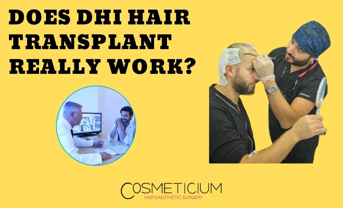 Does DHI Hair Transplantation Technique Really Work?