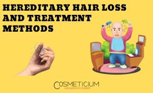 Hereditary Hair Loss
