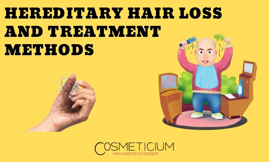 Hereditary Hair Loss and Treatment Methods - Cosmeticium