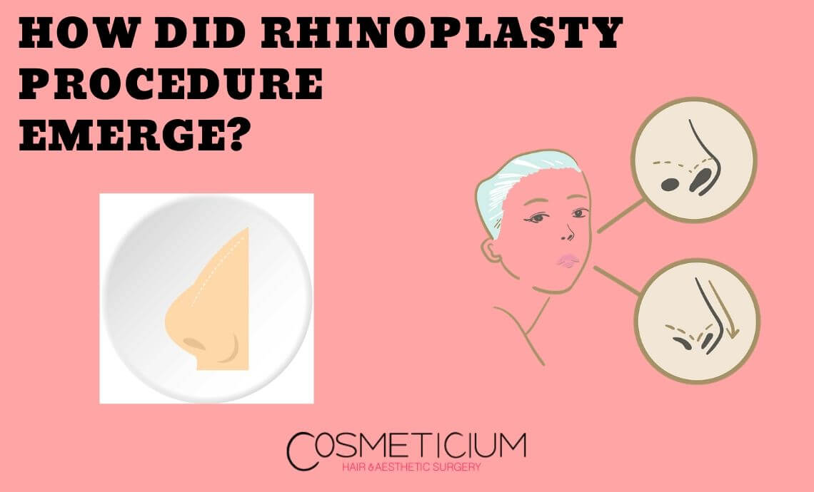 How Did Rhinoplasty Procedure Emerge?