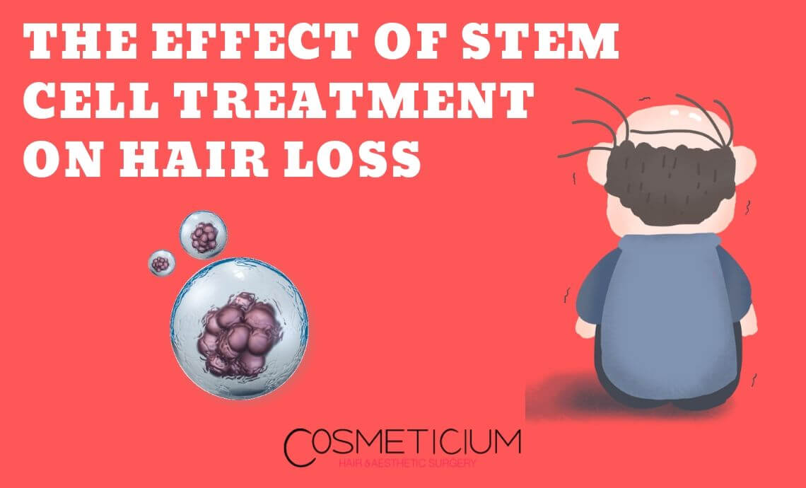 The Effect of Stem Cell Treatment on Hair Loss