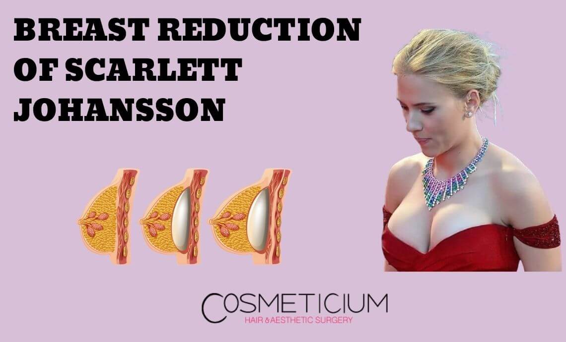 Scarlett johansson breast size