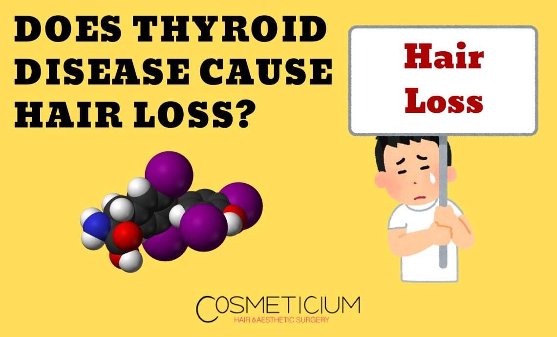 Does Thyroid Disease Cause Hair Loss?