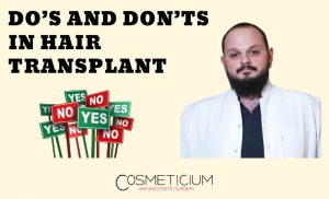 Pay attention to these before and after Hair Transplantation