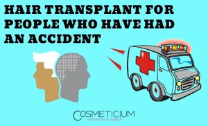 Hair Transplant for Victims of an Accident?