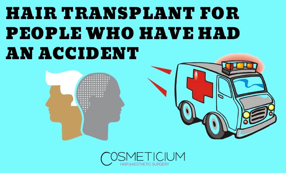 How is Hair Transplant Done for People Who Have Had an Accident?