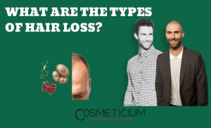 Hair Loss Types
