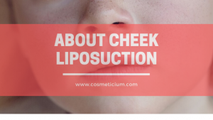 cheek liposuction