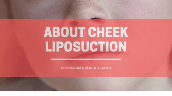 About Cheek Liposuction