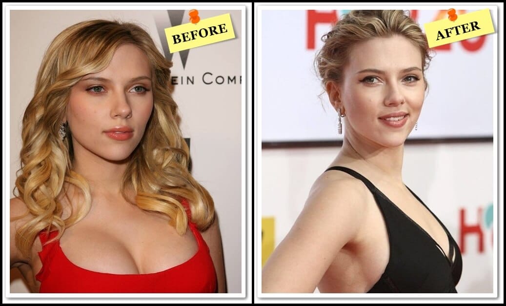 scarlett johansson before and after photo