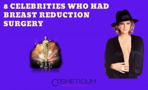 Breast Reduction Celebrities