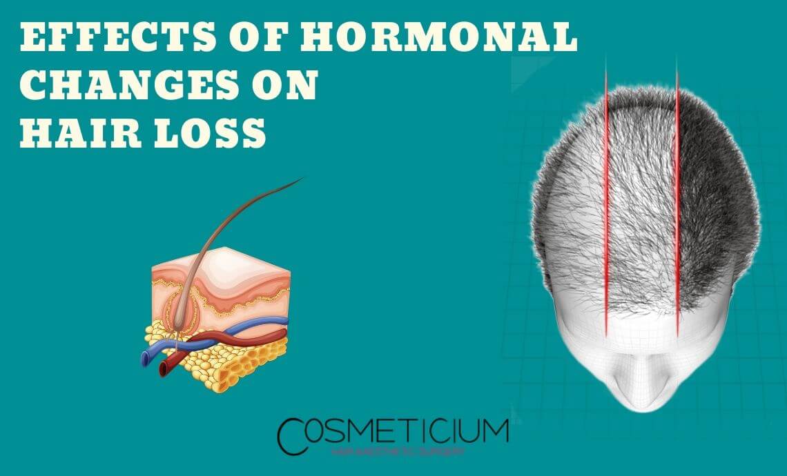 Effects of Hormonal Changes on Hair Loss