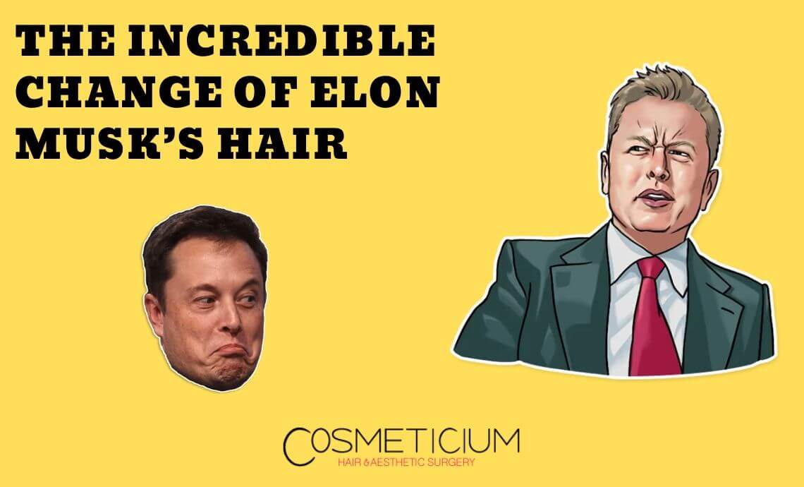 The Incredible Change of Elon Musk’s Hair (Before and After Photos)