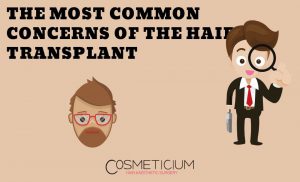 Concerns about Hair Transplant