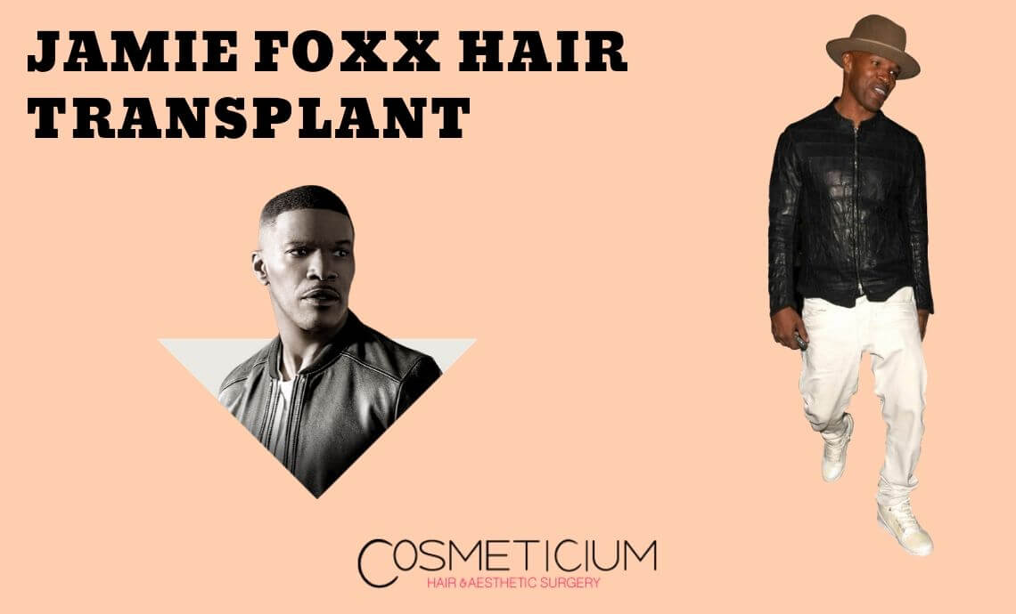 Jamie Foxx Hair Transplantation | Look at His Before & After Photos