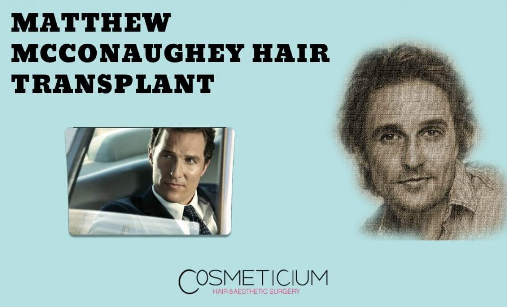 Matthew McConaughey Hair Transplant | All Secrets Revealed!