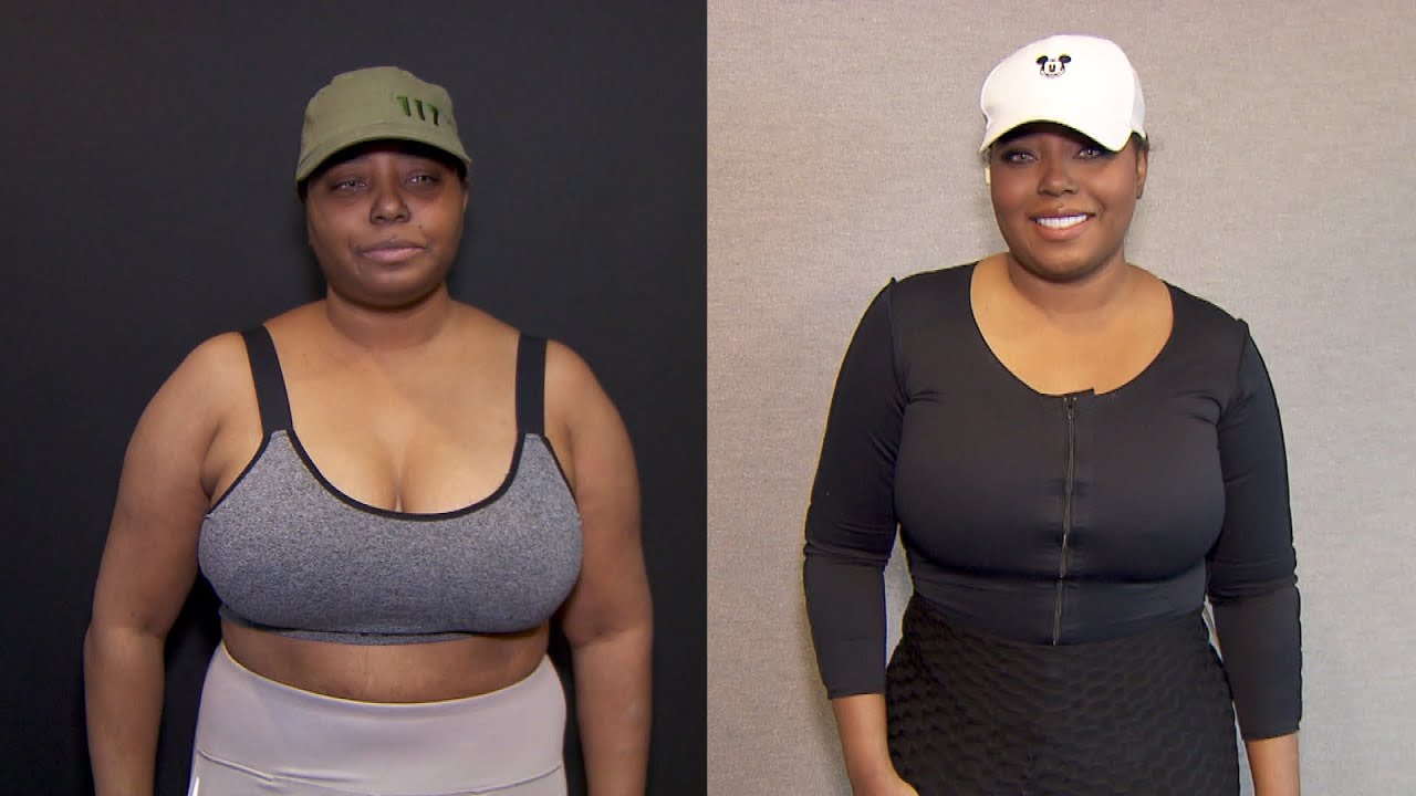 Shar Jackson tummy tuck