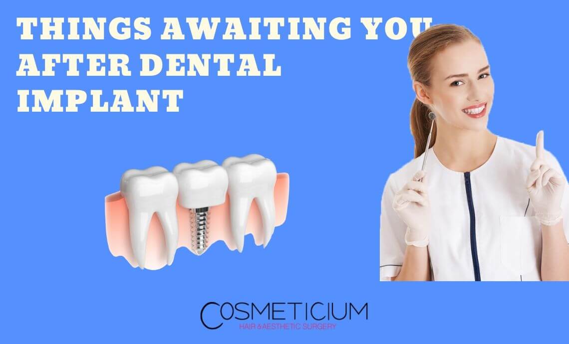 Things Awaiting You After Dental Implant Treatment