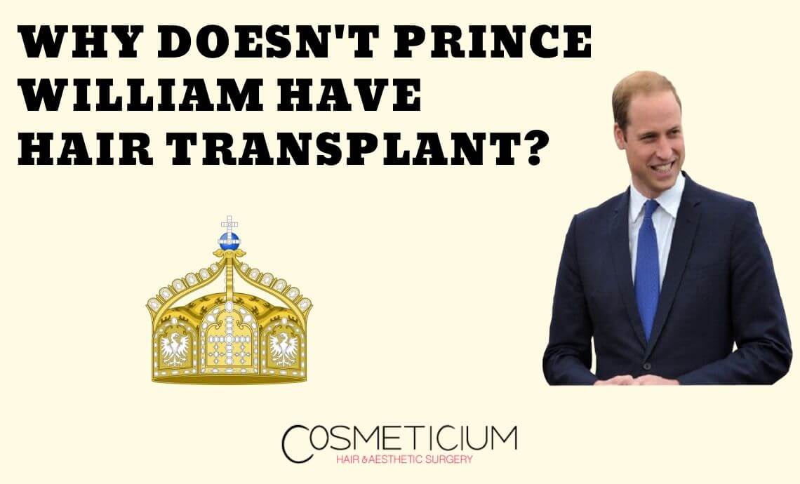 Why Doesn’t Prince William Have Hair Transplantation?