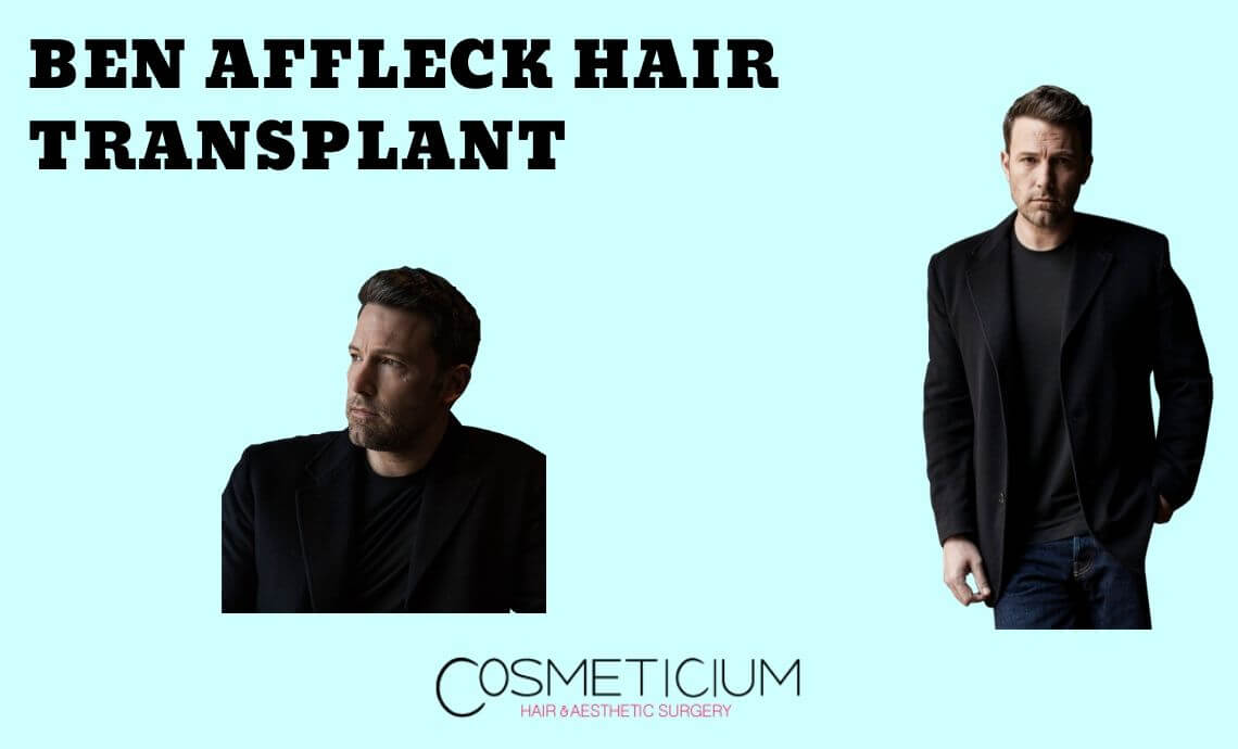 Ben Affleck Hair Transplantation: Know Everything about His Hair Secret