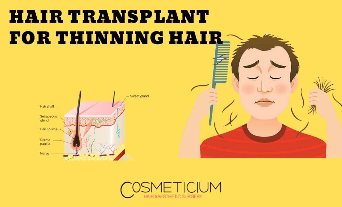 Hair Transplantation for Thinning Hair: What is the Difference?