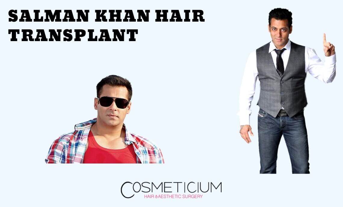 Why Did Salman Khan Undergo Hair Transplantation? | Cosmeticium