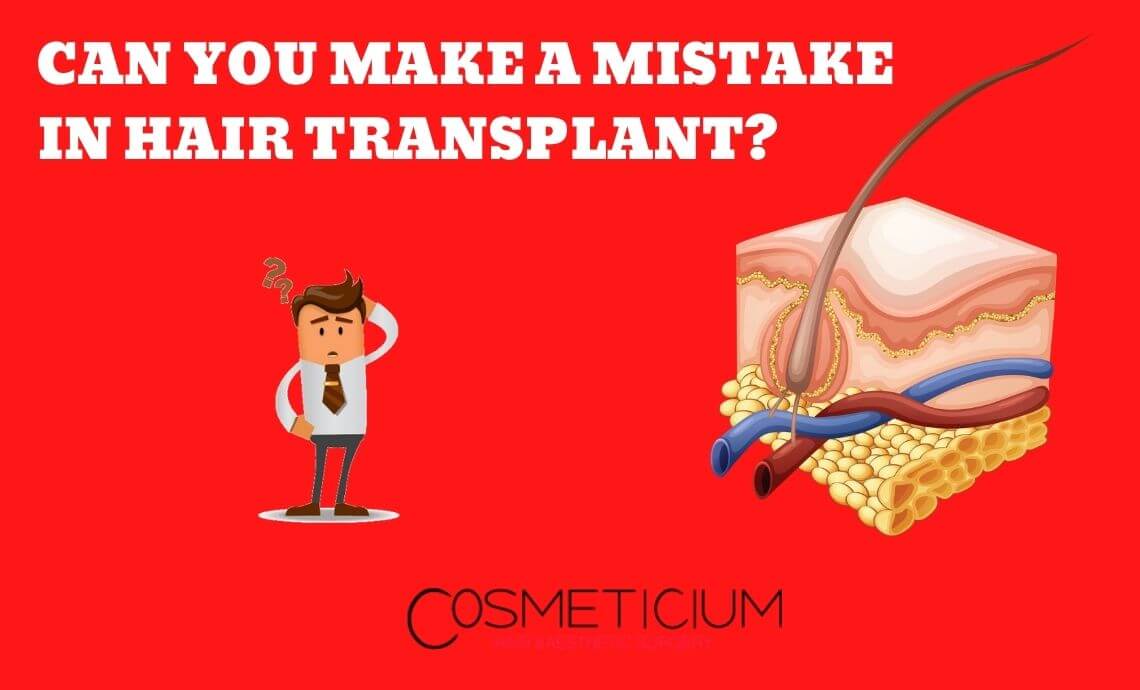 Can You Make A Mistake In Hair Transplantation?