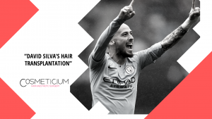 David Silva’s Hair Transplantation