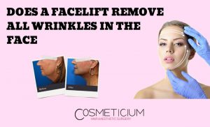Facelift can Remove All Wrinkles