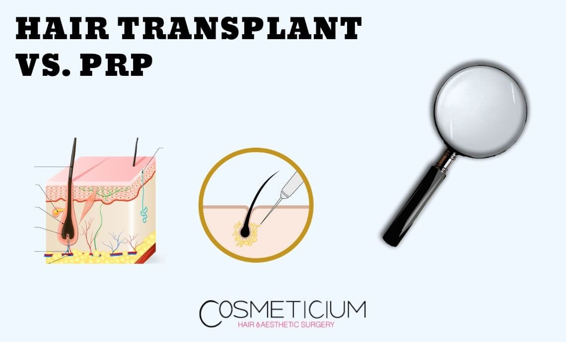Hair Transplant Vs. PRP | Which One Is Better?