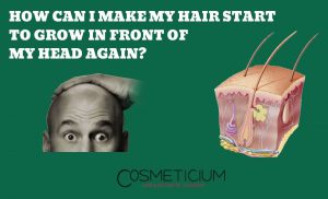 Hair Loss in Frontal Area of the head
