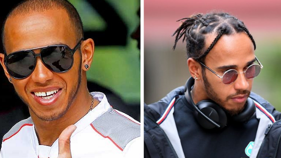 Lewis Hamilton’s Hair Transplantation New Look