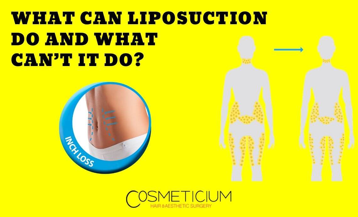 What Can Liposuction Do and What Can’t It Do?