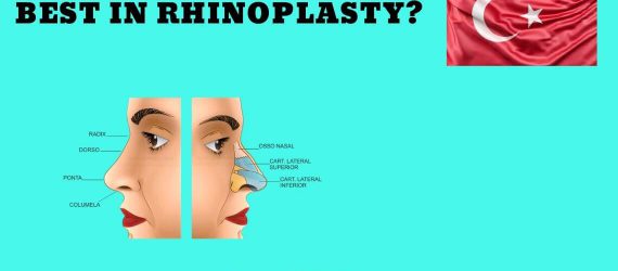 Rhinoplasty in Turkey