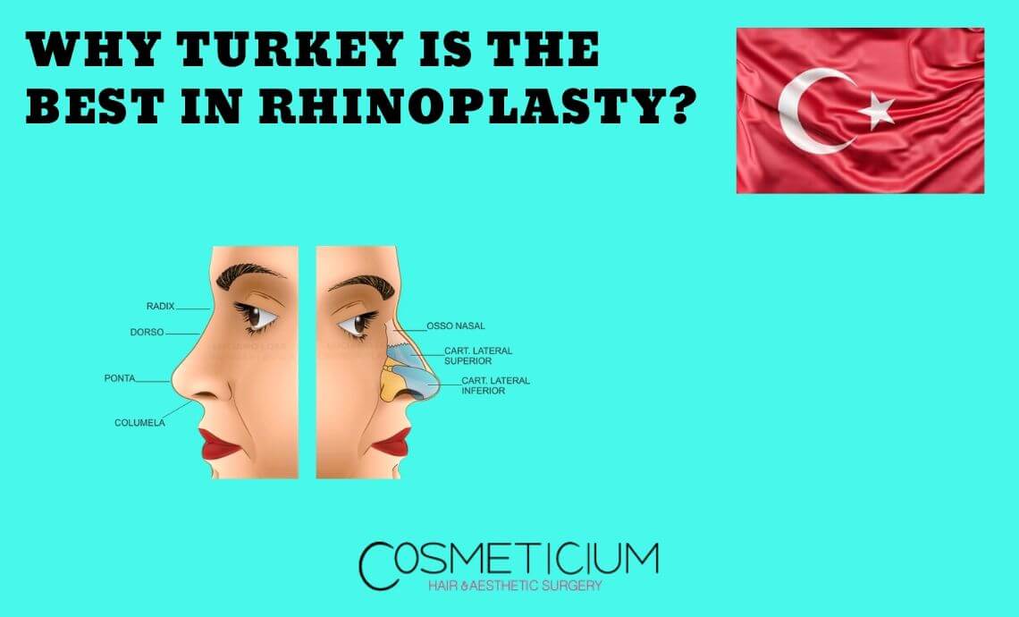 Why Turkey is The Best in Rhinoplasty Surgery?