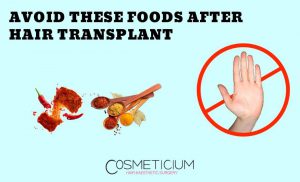 Foods Not Recommended After Hair Transplant