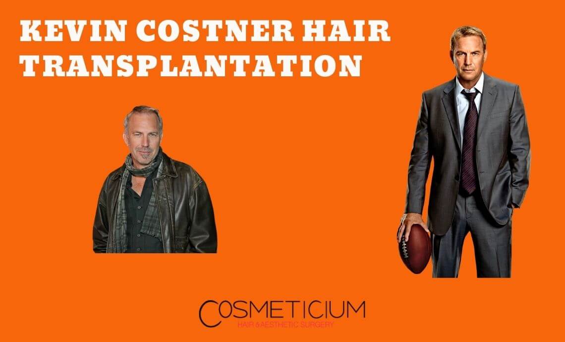 Kevin Costner’s Hair Transplantation from Disaster to Wonder