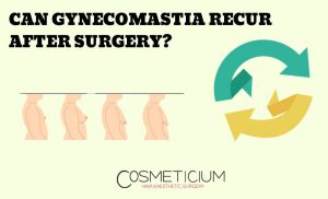 What are the Reasons for Gynecomastia Recurrence?