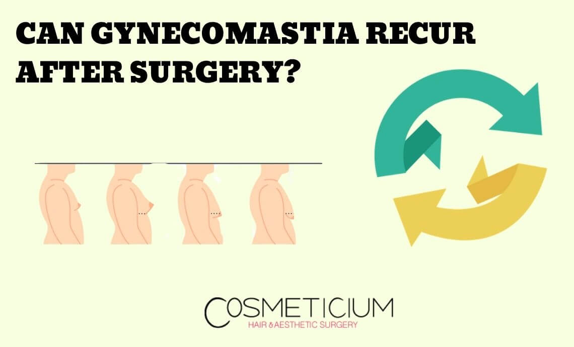 Can Gynecomastia Recur After Surgery?