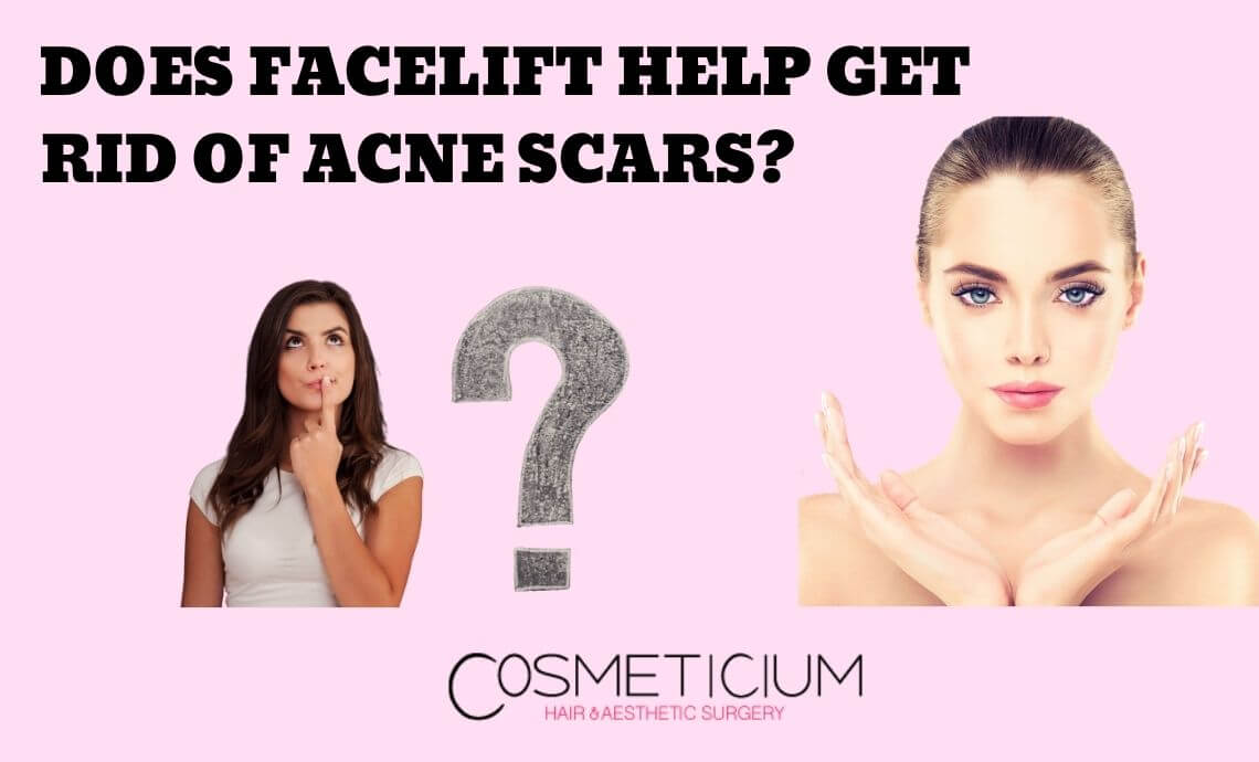 Does Facelift Procedure Help Get Rid of Acne Scars?