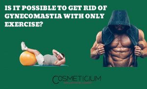Gynecomastia with Only Exercise