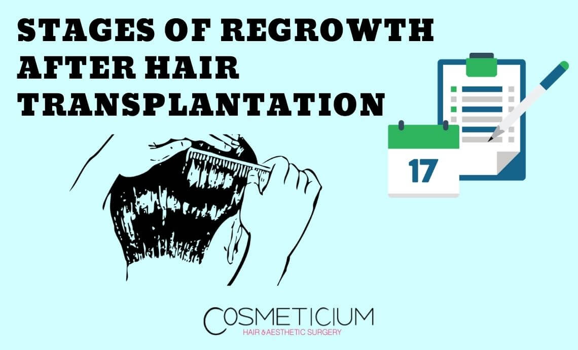 Stages of Regrowth After Hair Transplantation