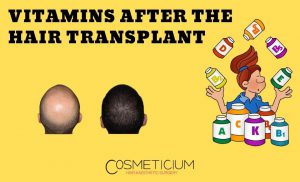 Vitamins After the Hair Transplantation